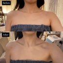 이연당 | 김포 피부관리 이연에스테틱 올리지업 2000샷 탄력관리 • 데콜테 관리 솔직 후기