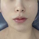 루시아 피부관리 | 김포 장기동 피부관리 루시아에스테틱 맞춤관리 후기