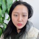 피부미인 | 경기도 구리 환절기 피부관리로 &#34;루미인뷰티&#34; 다녀온 후기!