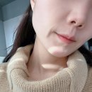 코차글로벌 | 얼굴라인정리 코셀라리프팅 3회차 변화후기