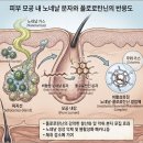 플로로