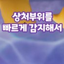 태선 티스토리