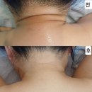 스킨케어 린 이미지