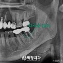 목동크라운치과의원 이미지