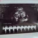 백아면 아산중기 앞 | [임신일기 #5] 임신중기 18주~20주차