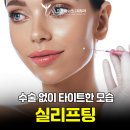 대구실리프팅 잘하는 곳 찾는다면