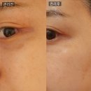 통정8로 | 천안 신방동 통정지구피부관리샵 추천 '유니앤코어라운지 천안점' 솔직 후기