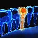 미소지음치과의원 이미지