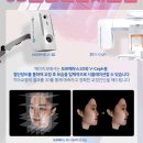제아시스템 네이버블로그
