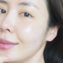 (주)아이디플라코스메틱 | 아이디플라코스메틱 엑소좀 홈케어 사용전후 솔직후기