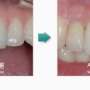 서울팀치과의원 이미지