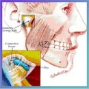턱관절 장애 와 그 해법 이미지