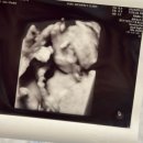 조아산부인과의원 이미지