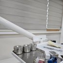 서울산보람병원 | 울산 언양 서울산보람병원 치과 어금니 발치 후기