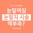 눈밑꺼짐 증상, 눈밑지 시술로는 안없어진다면 이미지