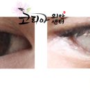 코리아의안센터 이미지