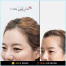 윤헤어라인의원