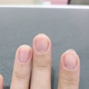 쏠라네일
