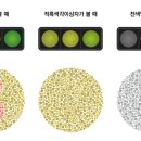 란돌트 아이케어 이미지