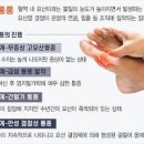 통풍 원인 초기 증상 치료 통풍 안 좋은 음식 통풍 통증 요산 수치 이미지