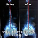 리얼리햅 맞춤운동센터 네이버블로그