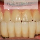 미래치과기공소 이미지