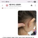 서초서울마더스2성형외과의원 네이버블로그