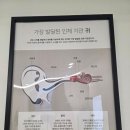 양산보청기 | 보청기잘하는곳 찾다가 정착한 양산보청기 후기