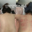 별하 | 호매실 바디관리 전문 별하에스테틱 등 관리 후기