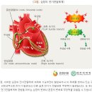 5대 심장질환 진단비 특별약관 이미지