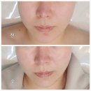 더 채움 | 부천피부관리 더채움에서 윤곽관리 후기
