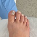 레푸스 연산점 이미지