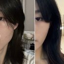 내돈내산 수술❌ 사각턱 보톡스 가장 효과보는 얼굴 특징 부작용까지 솔직정리