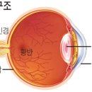 🍁No.471.녹내장 환자의 80% 안약으로 안압 낮춰 - 어떻게 치료하나 이미지