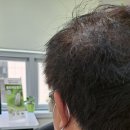 포낙보청기 고양일산센터 이미지