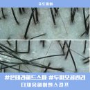 (주)테라앤 | 잠실헤드스파 송파에너지테라피 더채움헤어앤스칼프 온테라헤드스파 후기