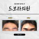 한양의원 | 강남 반영구 잘하는 곳 자연눈썹 솔직후기 드보라의원