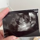 민트산부인과의원 | 아아주 어엄청 오랜만의 근황(시험관 시작, 결혼기념일,,인데,,이제 스케줄 왕창 꼬인..^^ㅎ)