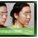 더라인 이미지