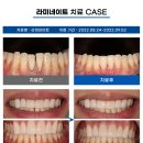 유성치과기공소 이미지
