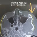 대낮 서울역 묻지마 폭행 사건.. 피해 여성 "아무도 도와주지 않았다, 무서워" 이미지