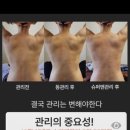 온니슬림림프관리 브레인테라필링 두피관리