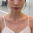 애프터쓰리 | 홀드랩 써마쓰리 한달 후기! 사각턱, 이중턱 써마3 리프팅 디바이스