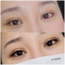 여기속눈썹