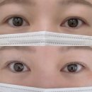 요이에스테틱 | 수유역피부관리 전문점 '요이에스테틱' 속눈썹펌 후기