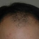 닥터안헤어플란트의원 이미지