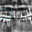 찬스플란트치과의원 이미지