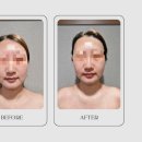원선화에스테틱 | 대구윤곽관리 예민피부도 안심! 원선화에스테틱 고객 리얼 후기