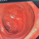 아산중앙내과의원 이미지