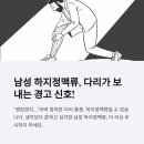 새봄병원 | 남자의 하지정맥류, 이제는 선택이 아닌 필수 관리